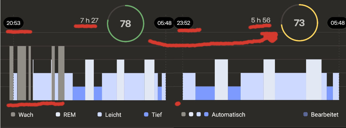 Withings: Schlafdaten korrigieren